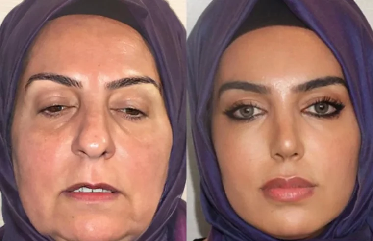 Renascimento Facial? Esse é o Poder da Rosa Turca!​